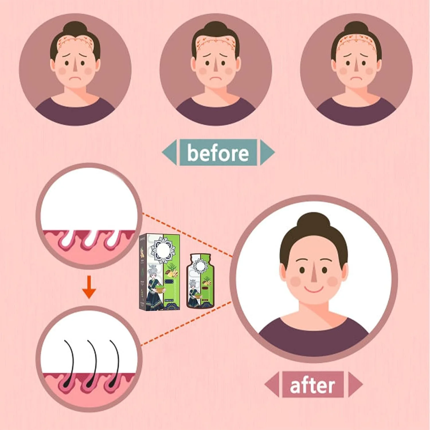 شامپو ضد ریزش مو با عصاره گیاه زنجبیل، شامپو رشد مو با عصاره گیاه زنجبیل، شامپو فعال کننده ریشه مو، شامپو ضد ریزش مو زنجبیل، شامپو عصاره گیاهی (3 جعبه) شامپو ضد ریزش مو با عصاره گیاه زنجبیل، شامپو رشد مو با عصاره گیاه زنجبیل، شامپو فعال کننده ریشه مو، شامپو ضد ریزش مو زنجبیل، شامپو عصاره گیاهی (3 جعبه)