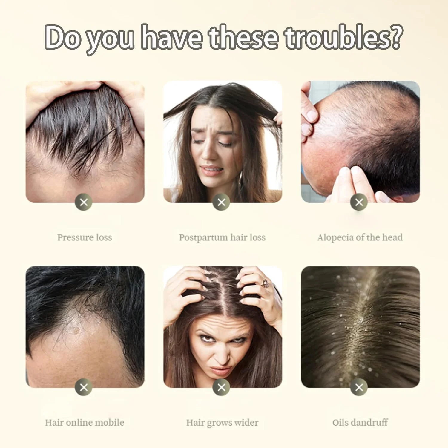 شامپو ضد ریزش مو با عصاره گیاه زنجبیل، شامپو زنجبیل برای رشد مو، شامپو ضد ریزش مو برای زنان (2 عدد) شامپو ضد ریزش مو با عصاره گیاه زنجبیل، شامپو زنجبیل برای رشد مو، شامپو ضد ریزش مو برای زنان (2 عدد)