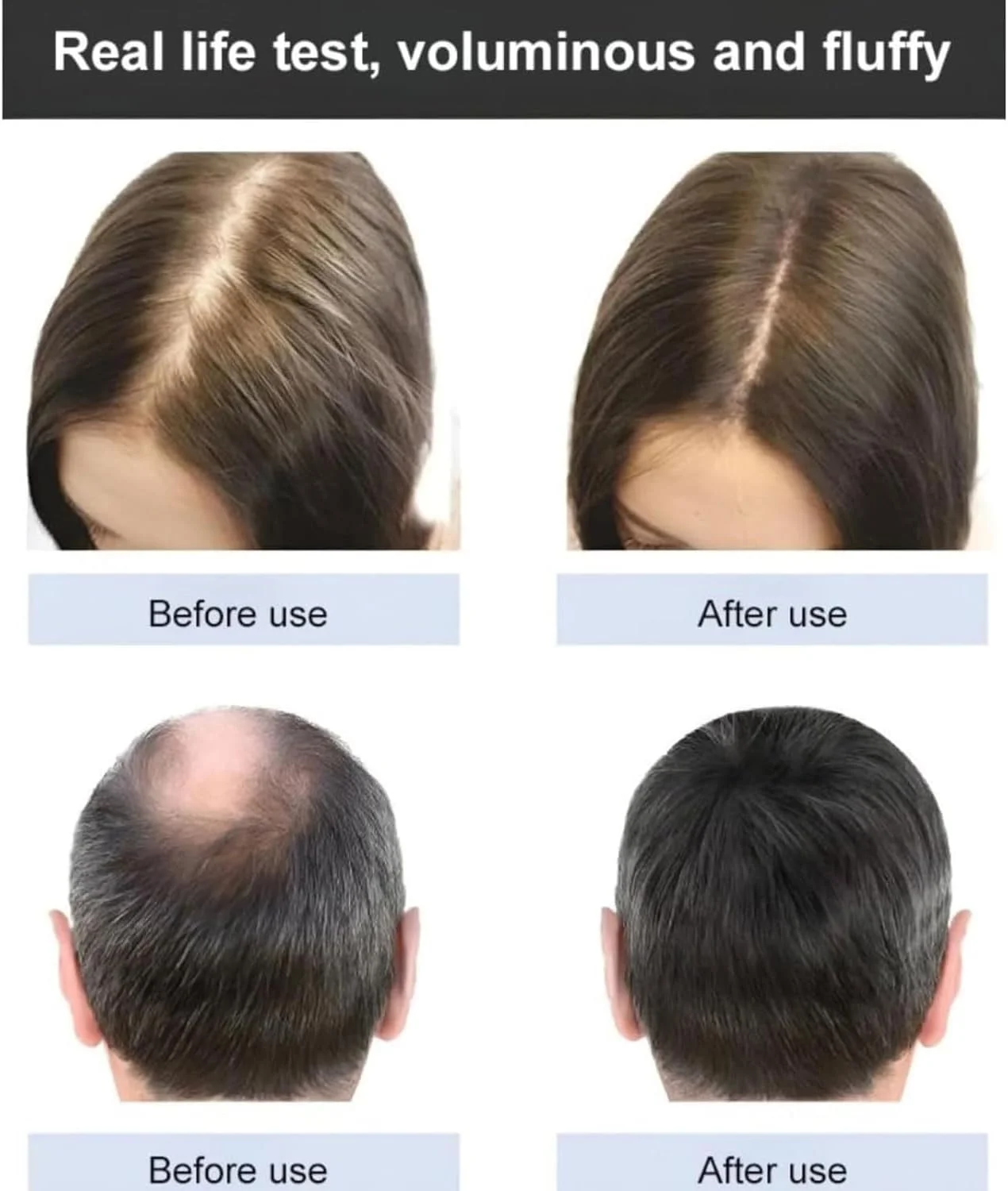 شامپو مو حاوی عصاره گیاه زنجبیل، ضد ریزش مو، مناسب برای انواع مو (3 عدد) شامپو مو حاوی عصاره گیاه زنجبیل، ضد ریزش مو، مناسب برای انواع مو (3 عدد)