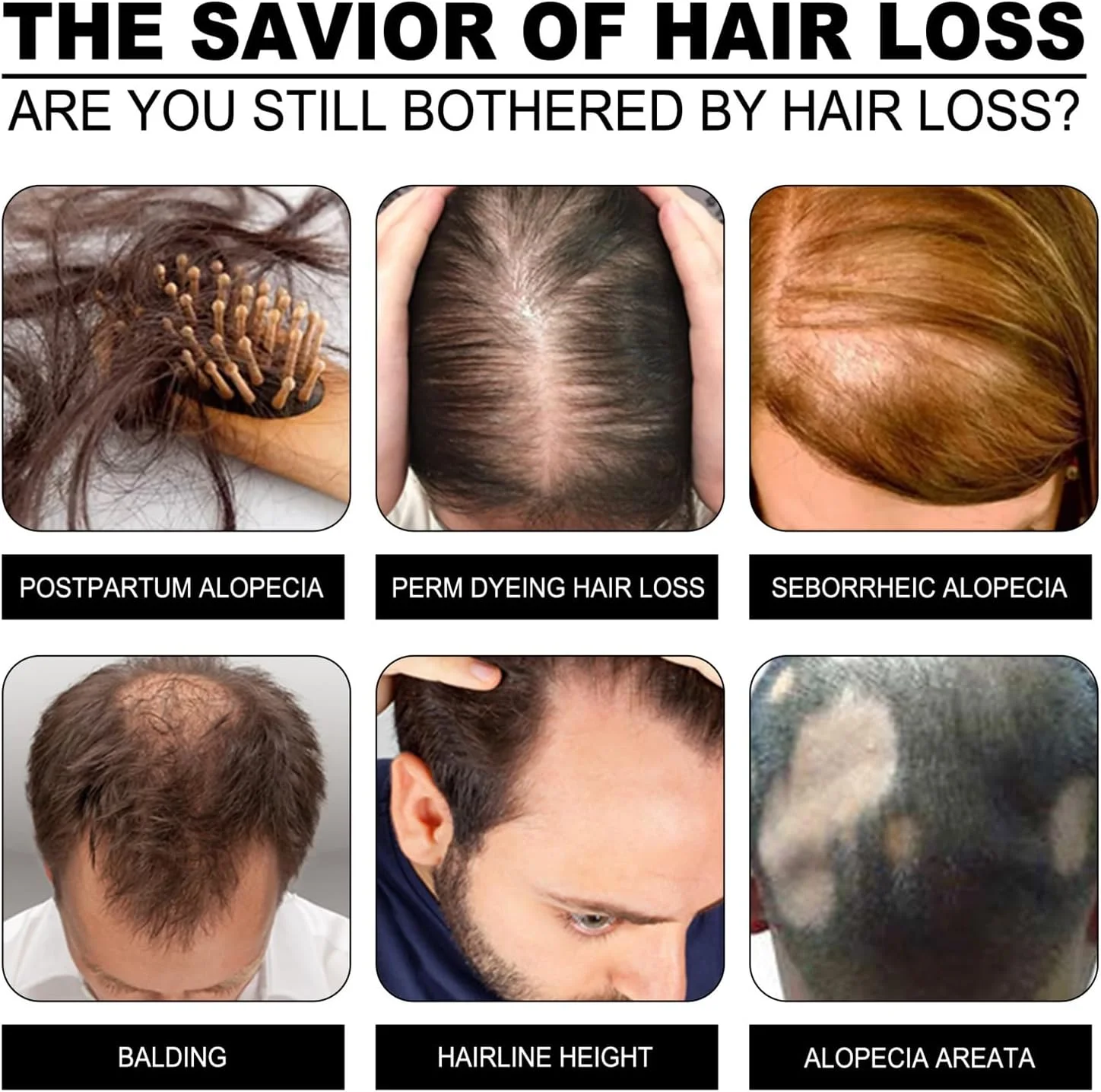 شامپو بار زنجبیلی برای رشد مجدد مو - مراقبت از مو با زنجبیل - شامپو برای موهای چرب - ضد ریزش مو، تحریک کننده، احیا کننده مواد مغذی - ترمیم فولیکول ها، کاهش شکستگی و وز شدن مو - ضخیم کننده و تقویت کننده درمان ریشه شامپو بار زنجبیلی برای رشد مجدد مو - مراقبت از مو با زنجبیل - شامپو برای موهای چرب - ضد ریزش مو، تحریک کننده، احیا کننده مواد مغذی - ترمیم فولیکول ها، کاهش شکستگی و وز شدن مو - ضخیم کننده و تقویت کننده درمان ریشه