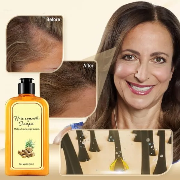 شامپو زنجبیل فوری Ginaday برای رشد مجدد مو، شامپو زنجبیل برای رشد مو، شامپو و نرم کننده ضد ریزش مو (280 میلی لیتر، شامپو)
