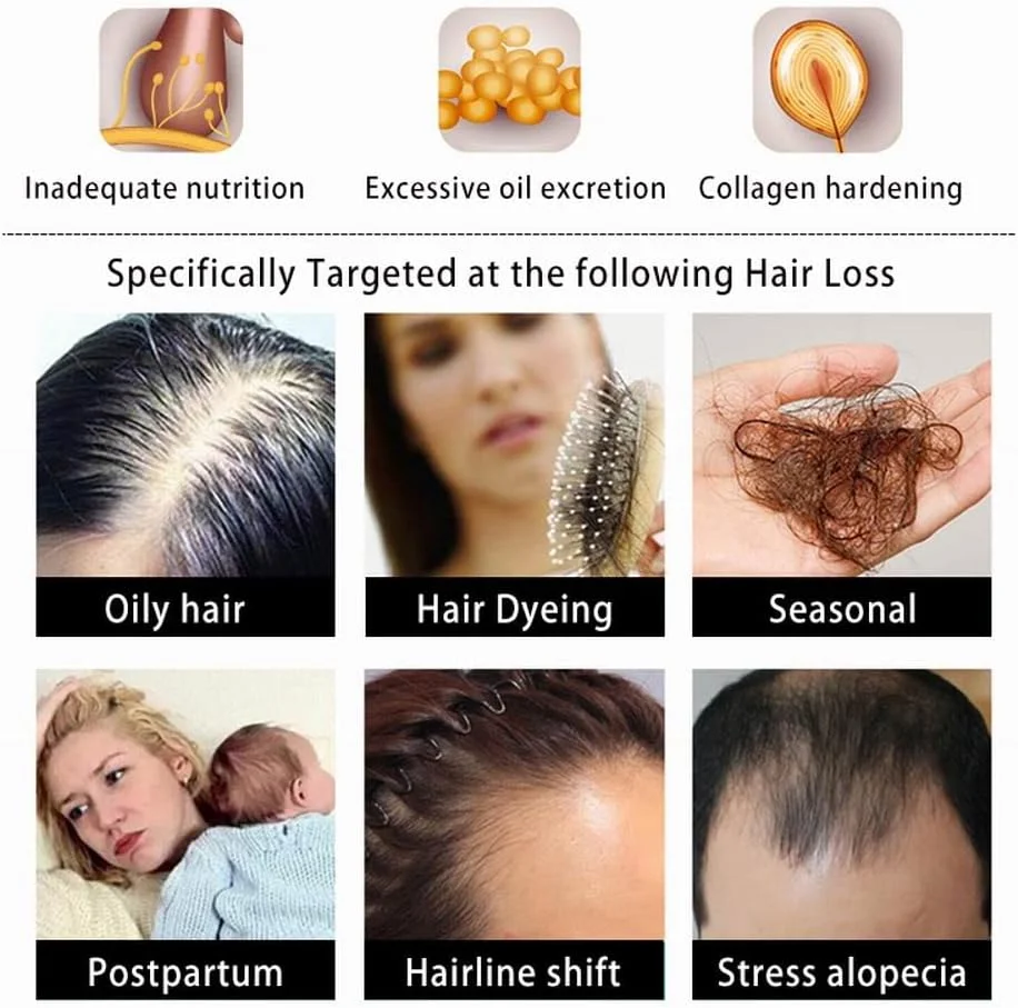 شامپو زنجبیل فوری Ginaday برای رشد مجدد مو، شامپو زنجبیل برای رشد مو، شامپو و نرم کننده ضد ریزش مو (280 میلی لیتر، شامپو)