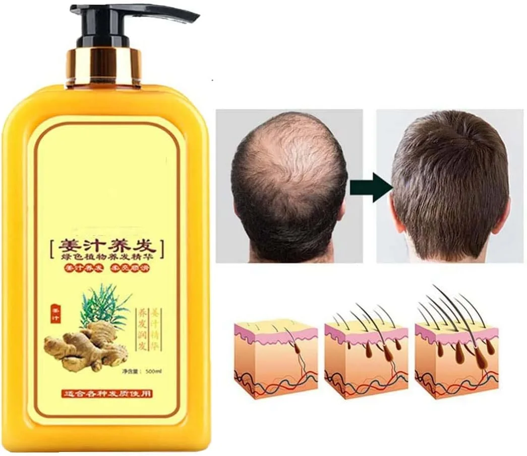 شامپو زنجبیل فوری رشد مجدد مو Ginaday، شامپو زنجبیل برای رشد مو، شامپو مراقبت از مو زنجبیل، شامپو ضد ریزش مو برای موهای نازک و ریزش مو (1 عدد)