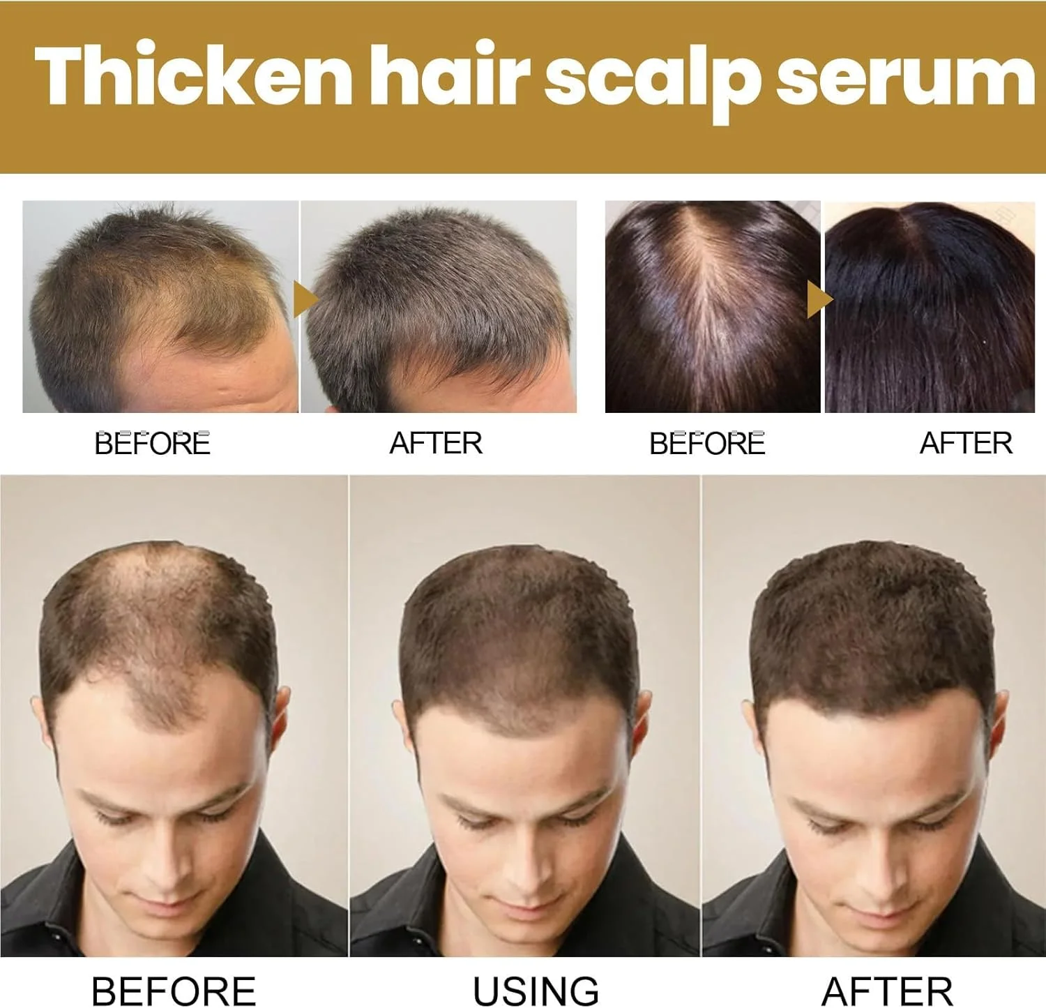 شامپو تقویت کننده مو Etaderm، شامپو ضد ریزش مو، شامپو و نرم کننده برای ریزش موی زنان، شامپو فعال کننده ریشه برای زنان و مردان (2 عدد) شامپو تقویت کننده مو Etaderm، شامپو ضد ریزش مو، شامپو و نرم کننده برای ریزش موی زنان، شامپو فعال کننده ریشه برای زنان و مردان (2 عدد)