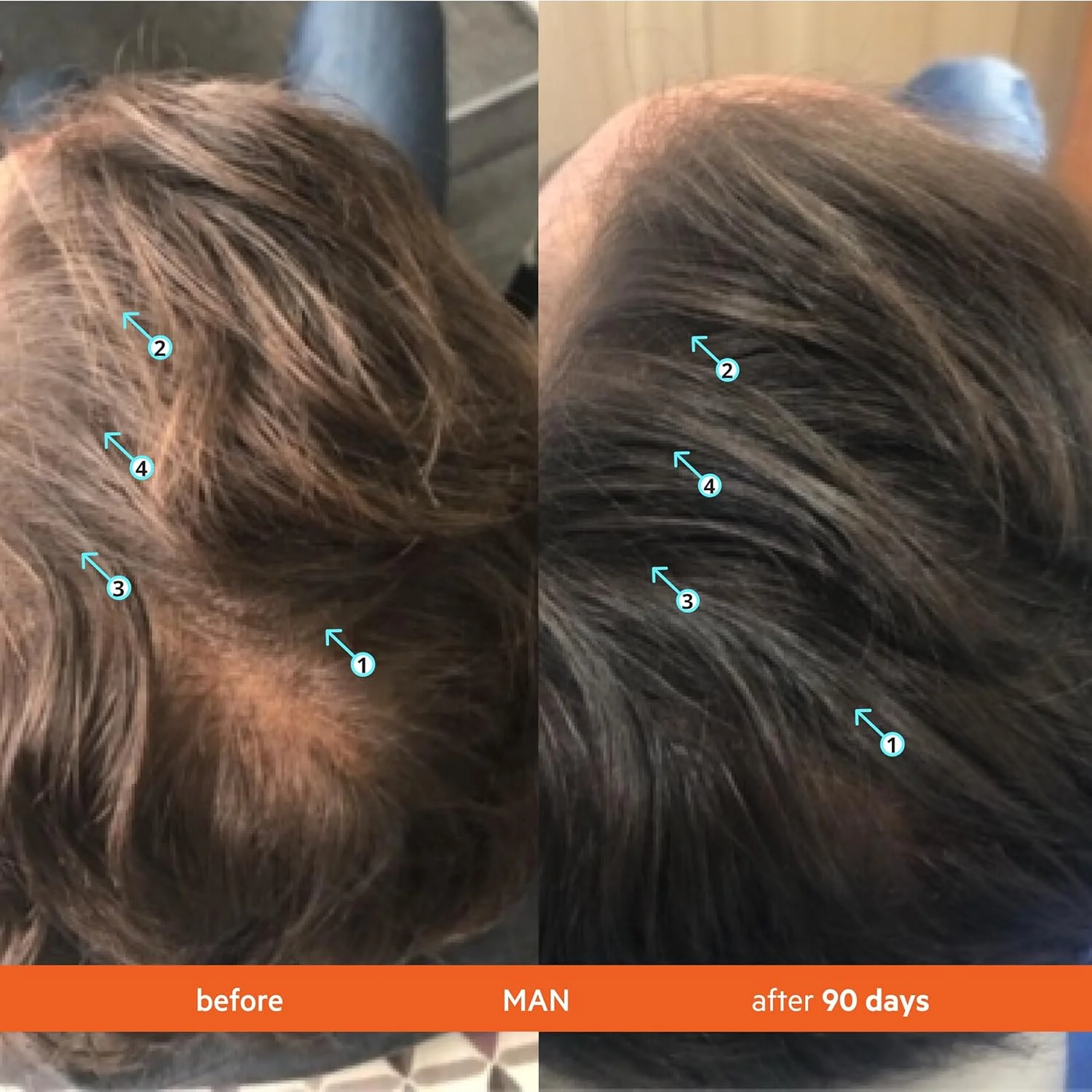 شامپو و نرم کننده رویتال DS Laboratories برای موهای نازک، پشتیبانی از رشد، تقویت و ضخیم کننده مو، بدون سولفات، مسدود کننده DHT، 205 میلی لیتر شامپو و نرم کننده رویتال DS Laboratories برای موهای نازک، پشتیبانی از رشد، تقویت و ضخیم کننده مو، بدون سولفات، مسدود کننده DHT، 205 میلی لیتر