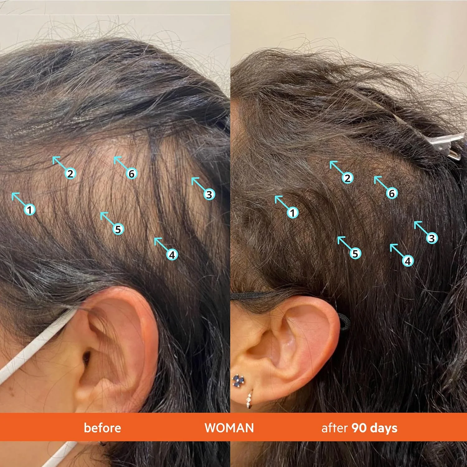 شامپو و نرم کننده رویتال DS Laboratories برای موهای نازک، پشتیبانی از رشد، تقویت و ضخیم کننده مو، بدون سولفات، مسدود کننده DHT، 205 میلی لیتر شامپو و نرم کننده رویتال DS Laboratories برای موهای نازک، پشتیبانی از رشد، تقویت و ضخیم کننده مو، بدون سولفات، مسدود کننده DHT، 205 میلی لیتر