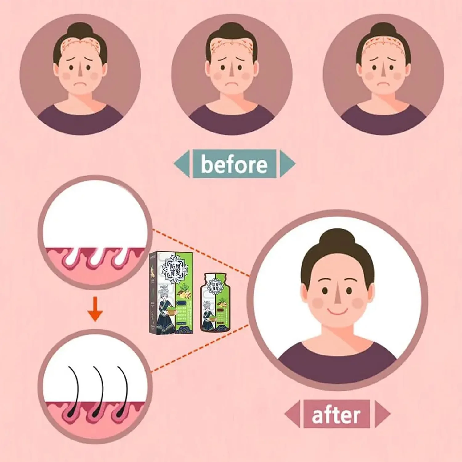 شامپو ضد ریزش مو زنجبیلی BONK، شامپو مو ضد ریزش مو با عصاره گیاه زنجبیل Polygonum Multiflorum، شامپو مراقبت از مو زنجبیلی