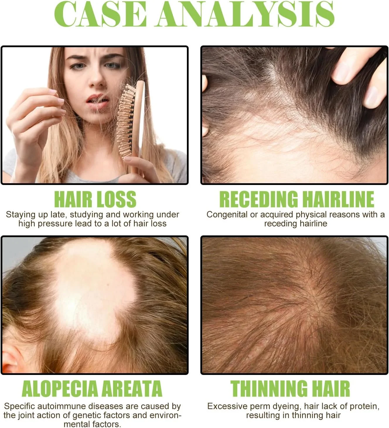 شامپو عصاره گیاه زنجبیل برای جلوگیری از ریزش مو، تقویت کننده فولیکول ها، تغذیه کننده مو و پوست سر، ترمیم و پاک کننده با مواد طبیعی، مراقبت ملایم برای انواع مو شامپو عصاره گیاه زنجبیل برای جلوگیری از ریزش مو، تقویت کننده فولیکول ها، تغذیه کننده مو و پوست سر، ترمیم و پاک کننده با مواد طبیعی، مراقبت ملایم برای انواع مو