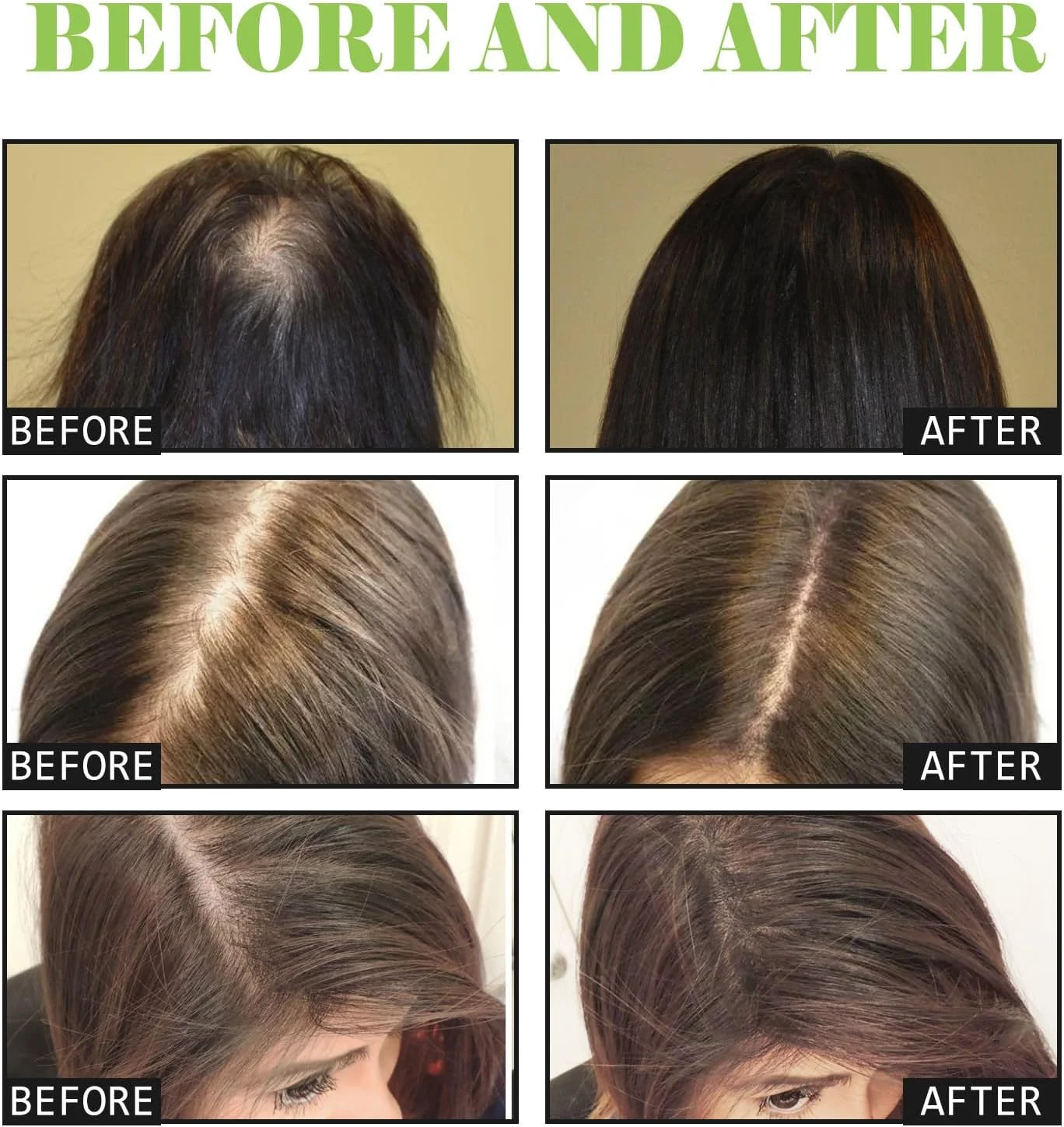 شامپو عصاره گیاه زنجبیل برای جلوگیری از ریزش مو، تقویت کننده فولیکول ها، تغذیه کننده مو و پوست سر، ترمیم و پاک کننده با مواد طبیعی، مراقبت ملایم برای انواع مو شامپو عصاره گیاه زنجبیل برای جلوگیری از ریزش مو، تقویت کننده فولیکول ها، تغذیه کننده مو و پوست سر، ترمیم و پاک کننده با مواد طبیعی، مراقبت ملایم برای انواع مو