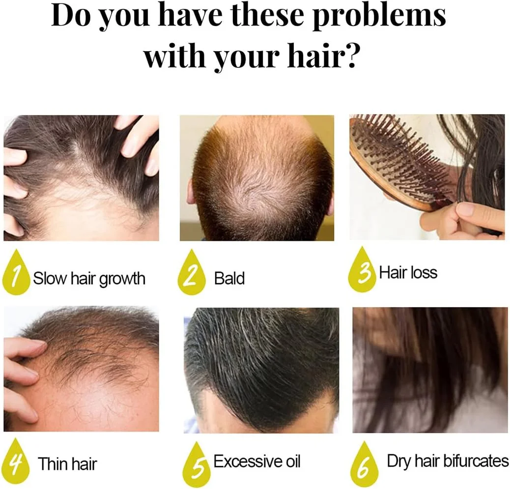 شامپو بار دست ساز با آب برنج، بدون سولفات، بدون فتالات، متعادل کننده PH، بدون تست حیوانی و وگان، درمان موهای خشک و آسیب دیده، کمک به توقف خارش پوست سر، مناسب برای انواع مو