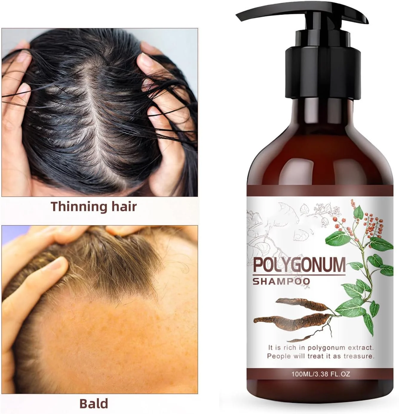 شامپو Polygonum Multiflorum، شامپو رشد مو 100 میلی لیتری برای موهای آسیب دیده، تغذیه عمیق و ترمیم موهای خشک، مناسب برای انواع مو، تقویت کننده بافت نرم، لطیف و سالم تر مو