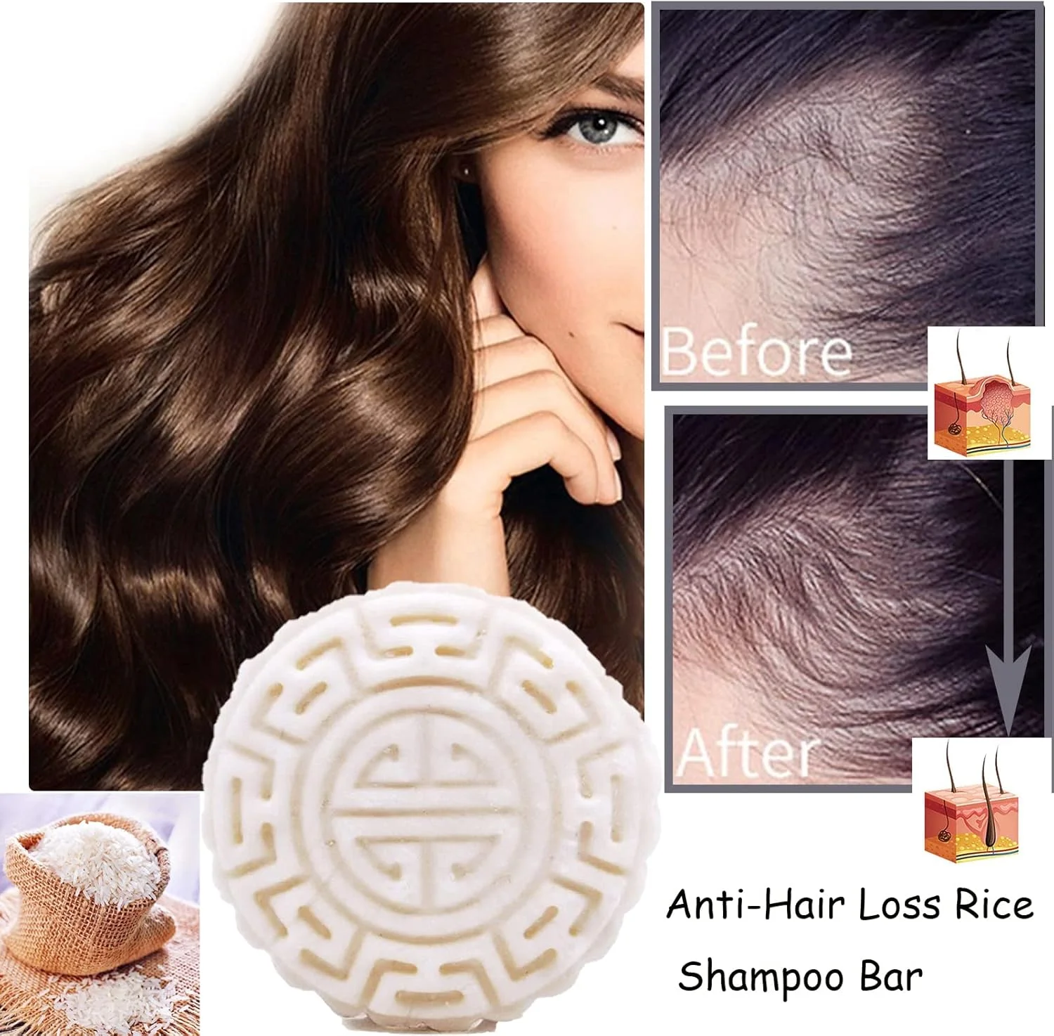 شامپو بار، شامپو و نرم کننده آب برنج برای رشد مو، شامپو جامد ضد ریزش مو برای زنان و مردان، نرم کننده مرطوب کننده، مغذی و نرم کننده ریشه موهای خشک و آسیب دیده - FOKFO