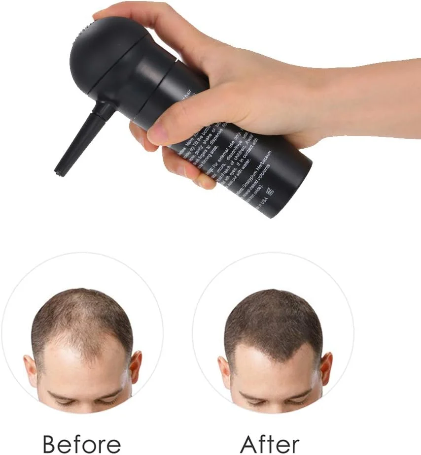 اسپری فیبر موی حرفه ای Anself BUNEE، نازل پمپ اپلیکاتور اسپری فیبر مو، ابزار ضخیم کننده مو