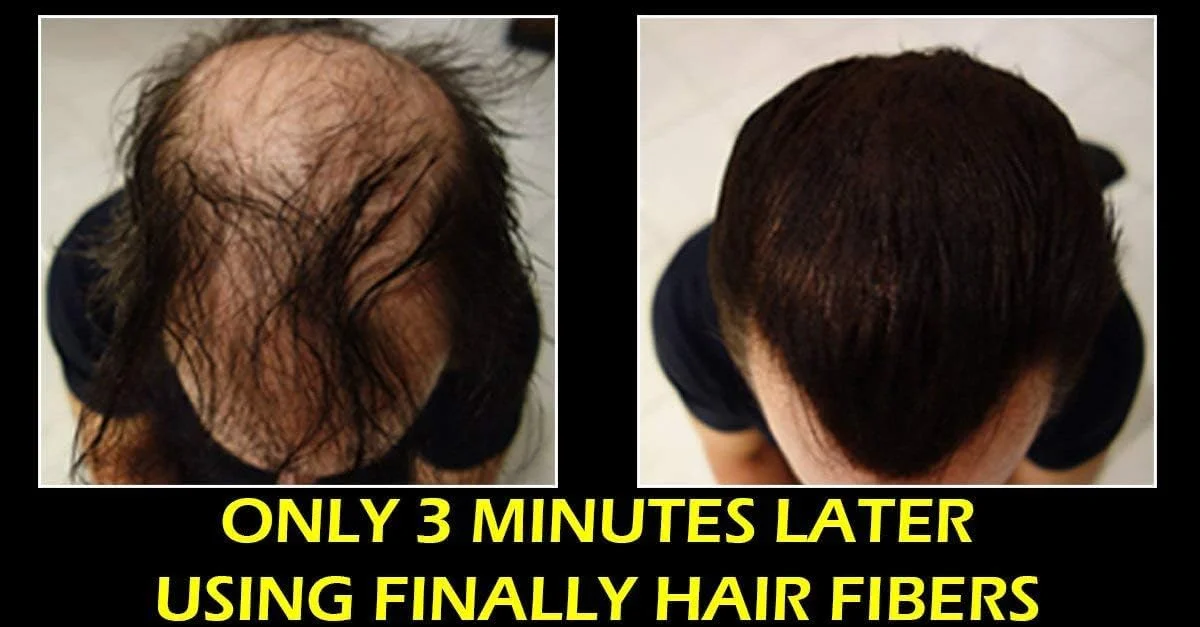 اسپری فیکس کننده قوی تارهای مو فاینلی هیر برای ثابت نگه داشتن تارهای مو. سازگار/جایگزین برای اسپری نگهدارنده تارهای مو از تاپیک، Xfusion، Febron، Bosley، Nanogen