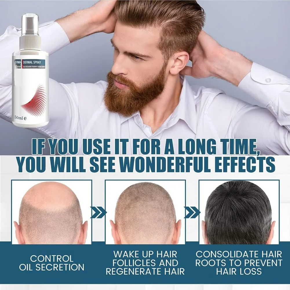 اسپری تقویت کننده مو AccretePRO، اسپری بافت دهنده برای حجم دهی مو، اسپری حجم دهنده موی کرکی 50 میلی لیتری، اسپری طبیعی مغذی پوست سر برای موهای نازک و ریزش مو، برای زنان و مردان (5 عددی)