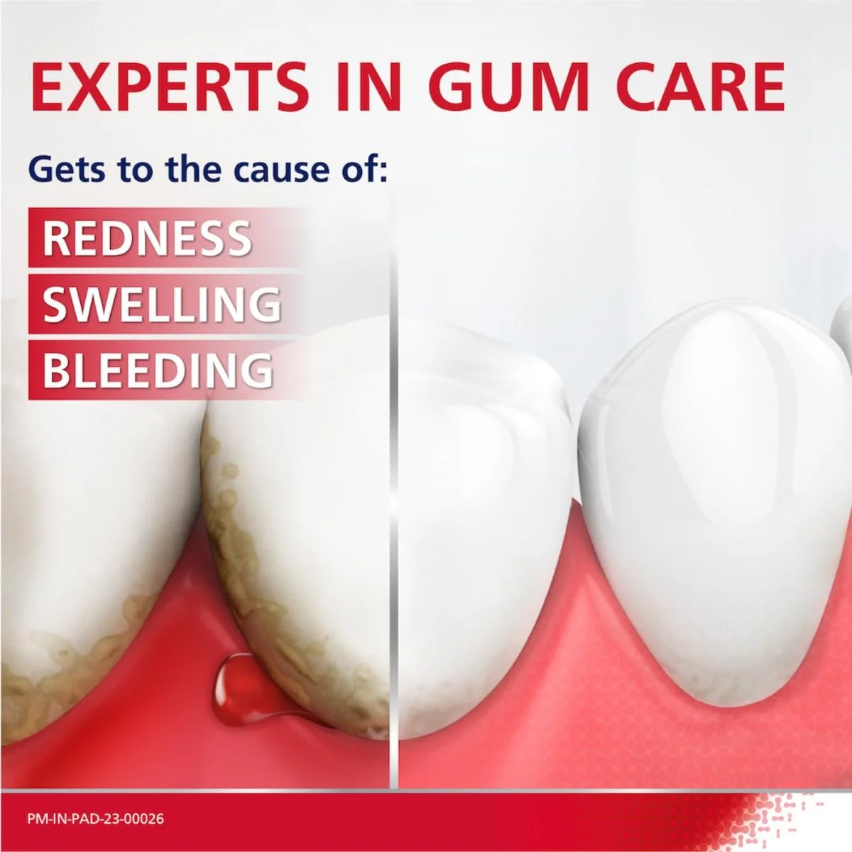 خمیر دندان پارودونتکس Ultra Clean برای محافظت روزانه در برابر مشکلات لثه، برای احساس فوق العاده تمیزی ماندگار، بسته چندتایی، 75 گرم * 2