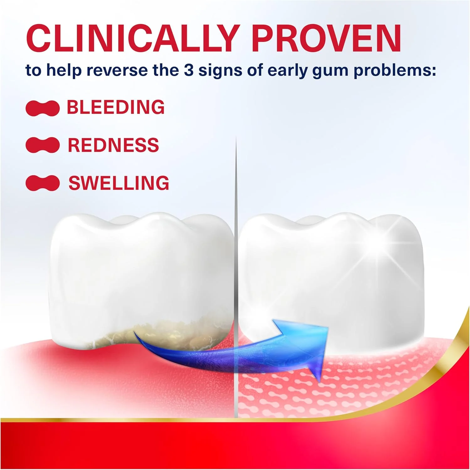 خمیر دندان ترمیم کننده فعال لثه Parodontax، خمیر دندان لثه برای کمک به معکوس کردن علائم اولیه بیماری لثه برای سلامت لثه، با طعم نعناع تازه - 96 گرم (3 عدد)