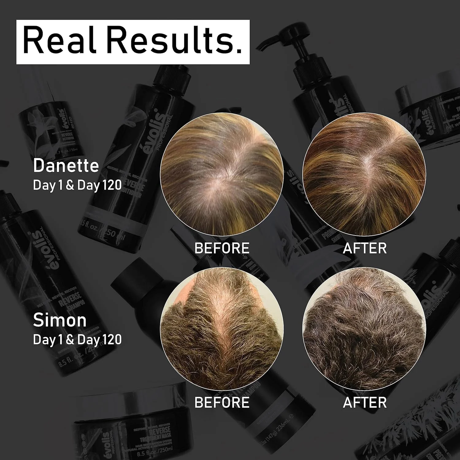 ماسک درمانی حرفه ای Evolis مدل Promote حجم 228 گرم