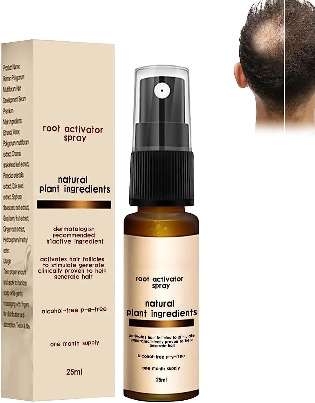 اسپری فعال کننده ریشه مو بلوسومز لاکچری، اسپری فعال کننده ریشه مو بلوسومز، اسپری رشد مو، سرم ضد ریزش مو، اسپری مراقبت از مو برای موهای خشک، آسیب دیده و نازک (1 عدد)