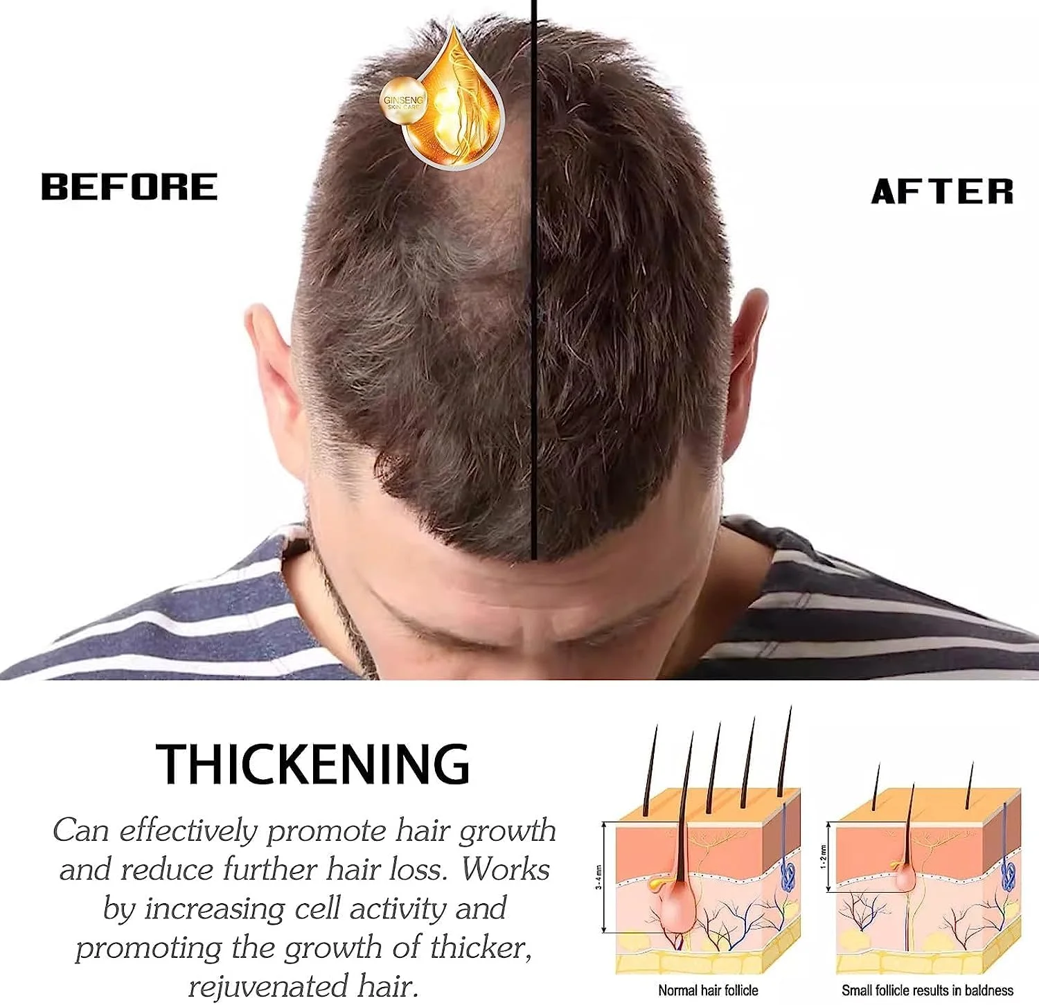 اسپری فعال کننده ریشه مو بلوسومز لاکچری، اسپری فعال کننده ریشه مو بلوسومز، اسپری رشد مو، سرم ضد ریزش مو، اسپری مراقبت از مو برای موهای خشک، آسیب دیده و نازک (1 عدد)