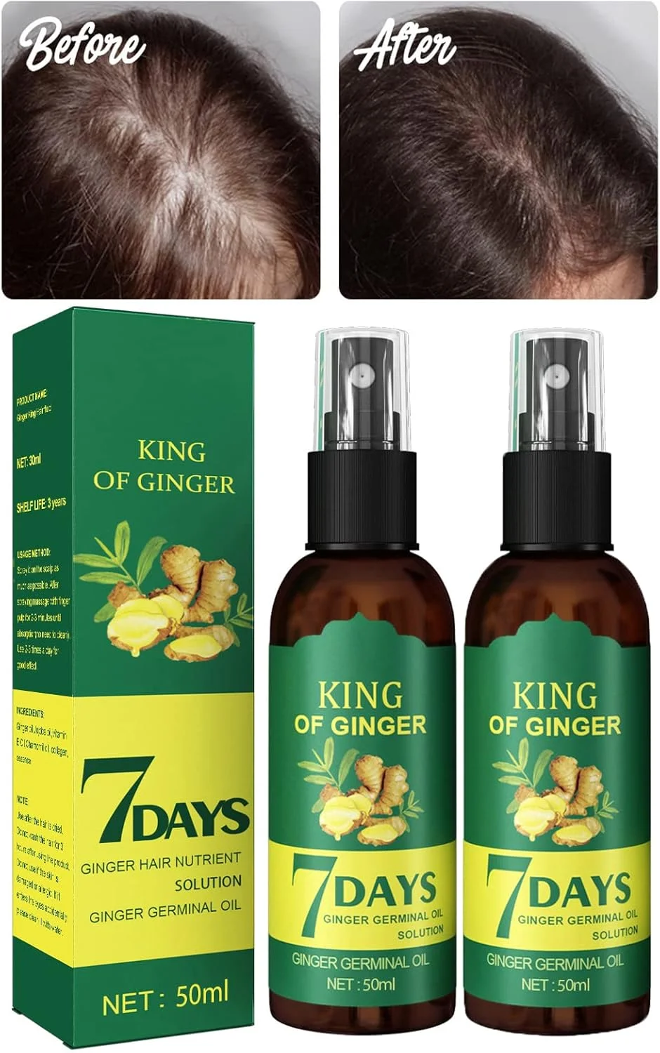 روغن تقویت کننده مو DIYIER Shouga Kingu، پادشاه زنجبیل برای رشد مو در 7 روز، اسپری رشد مو ژاپنی Shougagro، روغن زنجبیل برای رشد مو، روغن ضد ریزش مو (2 عدد)