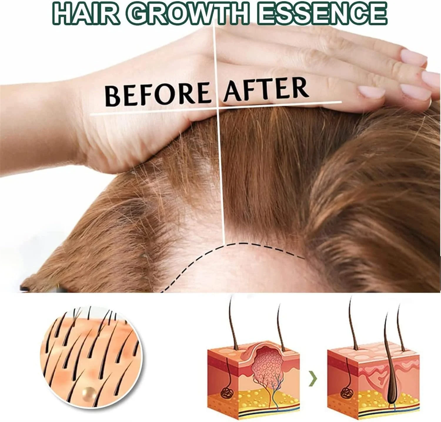 اسپری تقویت کننده و متراکم کننده مو، اسپری رشد مو با مواد معدنی، سرم ضد ریزش مو، اسانس رشد مجدد مو برای زنان و مردان، 30 میلی لیتر (1 عدد)