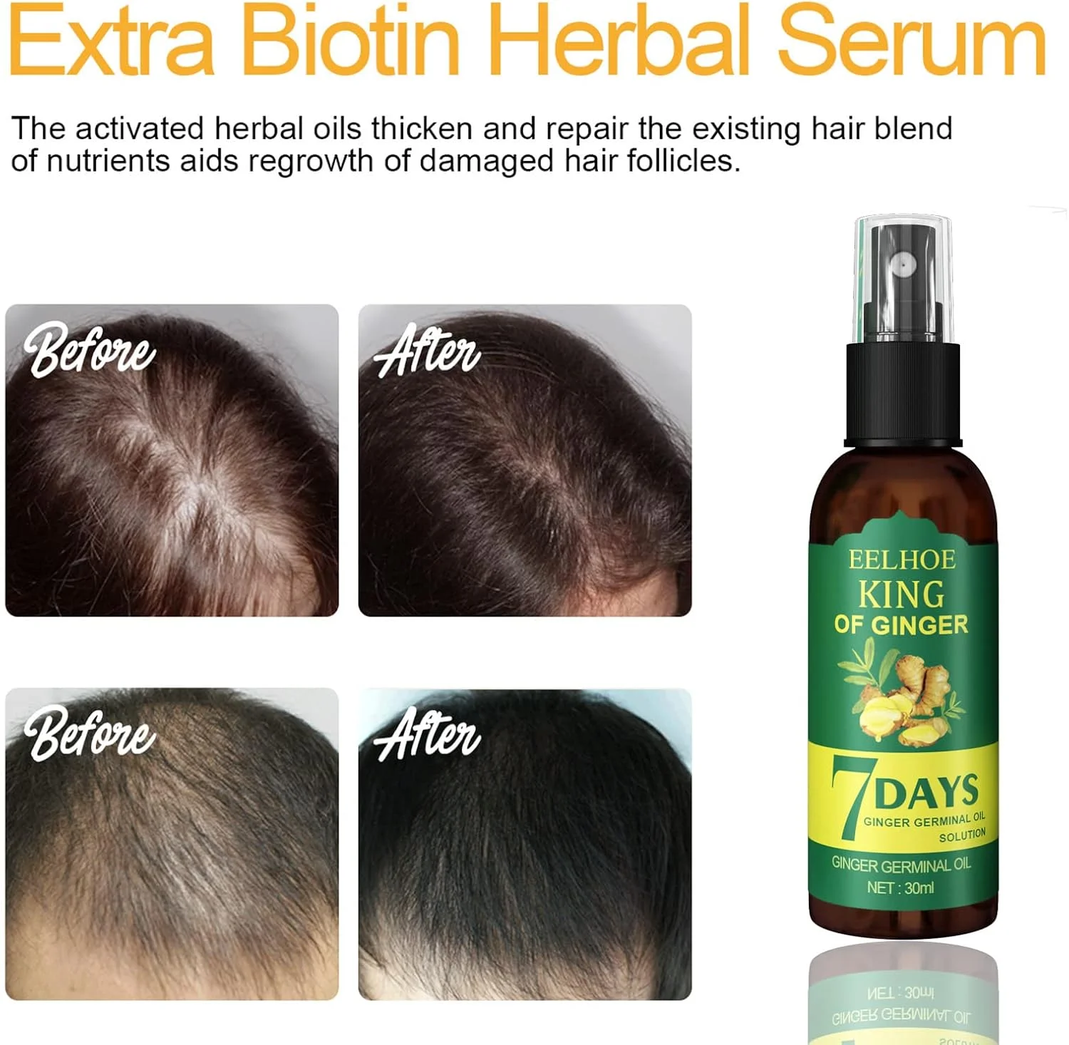 روغن تقویت کننده مو DIYIER Shouga Kingu، پادشاه زنجبیل برای رشد مو در 7 روز، اسپری رشد مو ژاپنی Shougagro، روغن زنجبیل برای رشد مو، روغن ضد ریزش مو (2 عدد)