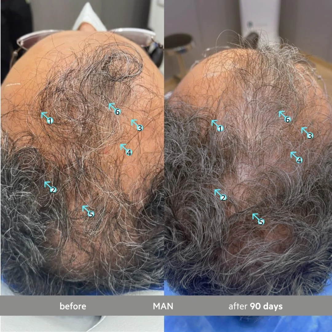 سرم ضد سفیدی مو و تقویت کننده موی سر دی اس لابراتوریز Spectral.DNC-S، با قدرت فوق العاده، مناسب برای آقایان و بانوان - احیا کننده رنگ مو، سرم ضد ریزش و نازک شدن مو برای داشتن موهایی پرپشت تر، 60 میلی لیتر سرم ضد سفیدی مو و تقویت کننده موی سر دی اس لابراتوریز Spectral.DNC-S، با قدرت فوق العاده، مناسب برای آقایان و بانوان - احیا کننده رنگ مو، سرم ضد ریزش و نازک شدن مو برای داشتن موهایی پرپشت تر، 60 میلی لیتر