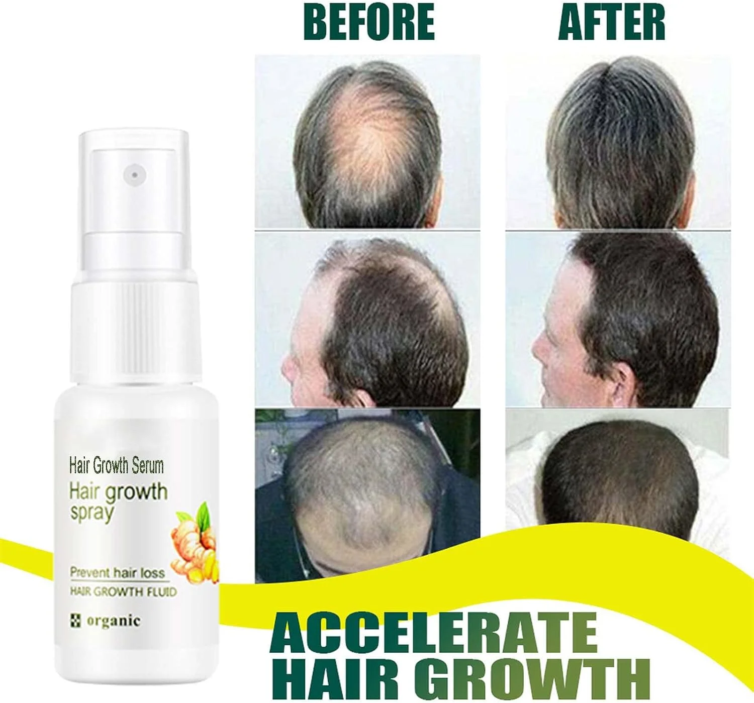 سرم رشد مو، اسپری و تقویت کننده رشد مو، اسپری ضخیم کننده مو و مراقبت از موی سر، ترمیم کننده فولیکول های مو، سرم های مو برای رشد مو، درمان ضد ریزش مو و رویش مجدد مو برای زنان و مردان، 20 میلی لیتر