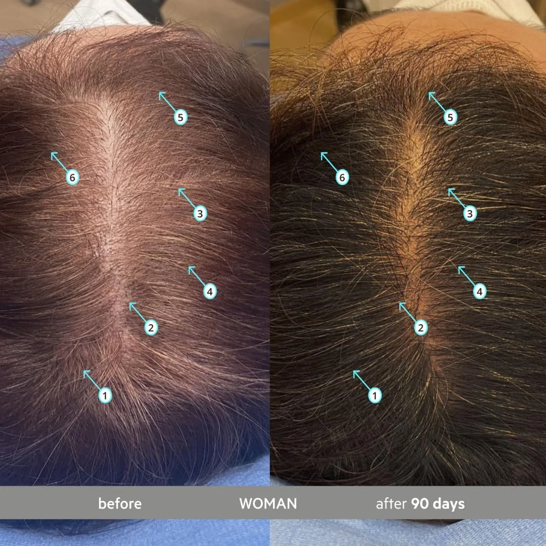 سرم ضد سفیدی مو و تقویت کننده موی سر دی اس لابراتوریز Spectral.DNC-S، با قدرت فوق العاده، مناسب برای آقایان و بانوان - احیا کننده رنگ مو، سرم ضد ریزش و نازک شدن مو برای داشتن موهایی پرپشت تر، 60 میلی لیتر سرم ضد سفیدی مو و تقویت کننده موی سر دی اس لابراتوریز Spectral.DNC-S، با قدرت فوق العاده، مناسب برای آقایان و بانوان - احیا کننده رنگ مو، سرم ضد ریزش و نازک شدن مو برای داشتن موهایی پرپشت تر، 60 میلی لیتر