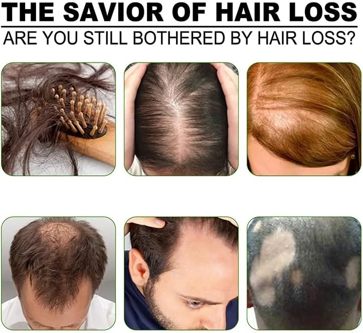 محلول ضد ریزش و رشد مو، شبنم ضد ریزش مو گیاهی یاوپین، مایع جلوگیری از ریزش مو بیوتیکومی، اسپری مراقبت از مو با عصاره زنجبیل شووو سیاه (2 عدد)