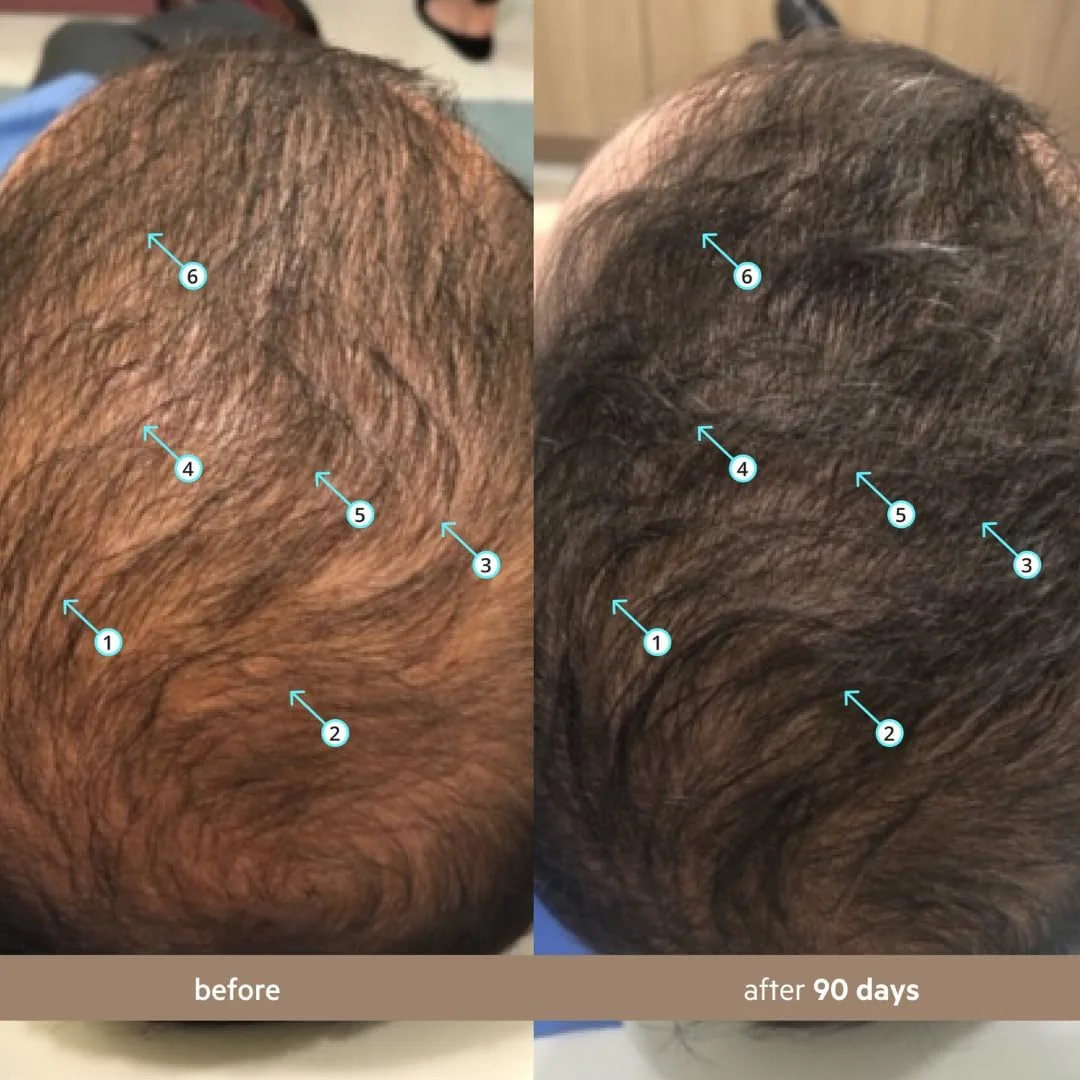 سرم افزایش تراکم مو مردانه DS Labs Spectral، فرمول Spectral.DNC-N - تقویت کننده، ضخیم کننده، کاهش ریزش، ایمن برای موهای رنگ شده، 60 میلی لیتر، بسته بندی ممکن است متفاوت باشد سرم افزایش تراکم مو مردانه DS Labs Spectral، فرمول Spectral.DNC-N - تقویت کننده، ضخیم کننده، کاهش ریزش، ایمن برای موهای رنگ شده، 60 میلی لیتر، بسته بندی ممکن است متفاوت باشد