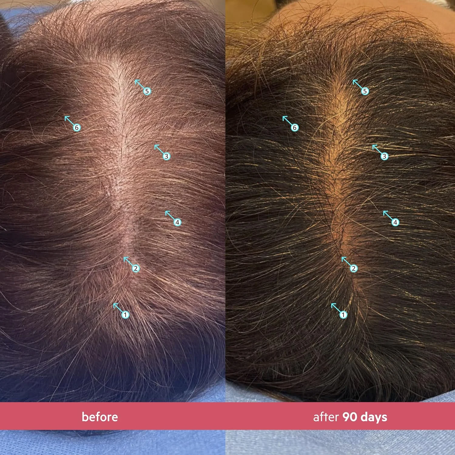 سرم افزایش تراکم موی زنان DS Labs Spectral (سابقا Spectral.CSF)، 60 میلی لیتر - سرم سبک و بدون نیاز به آبکشی برای موهایی پرپشت تر و ضخیم تر، جذب سریع، غیر چرب، مناسب برای انواع مو سرم افزایش تراکم موی زنان DS Labs Spectral (سابقا Spectral.CSF)، 60 میلی لیتر - سرم سبک و بدون نیاز به آبکشی برای موهایی پرپشت تر و ضخیم تر، جذب سریع، غیر چرب، مناسب برای انواع مو