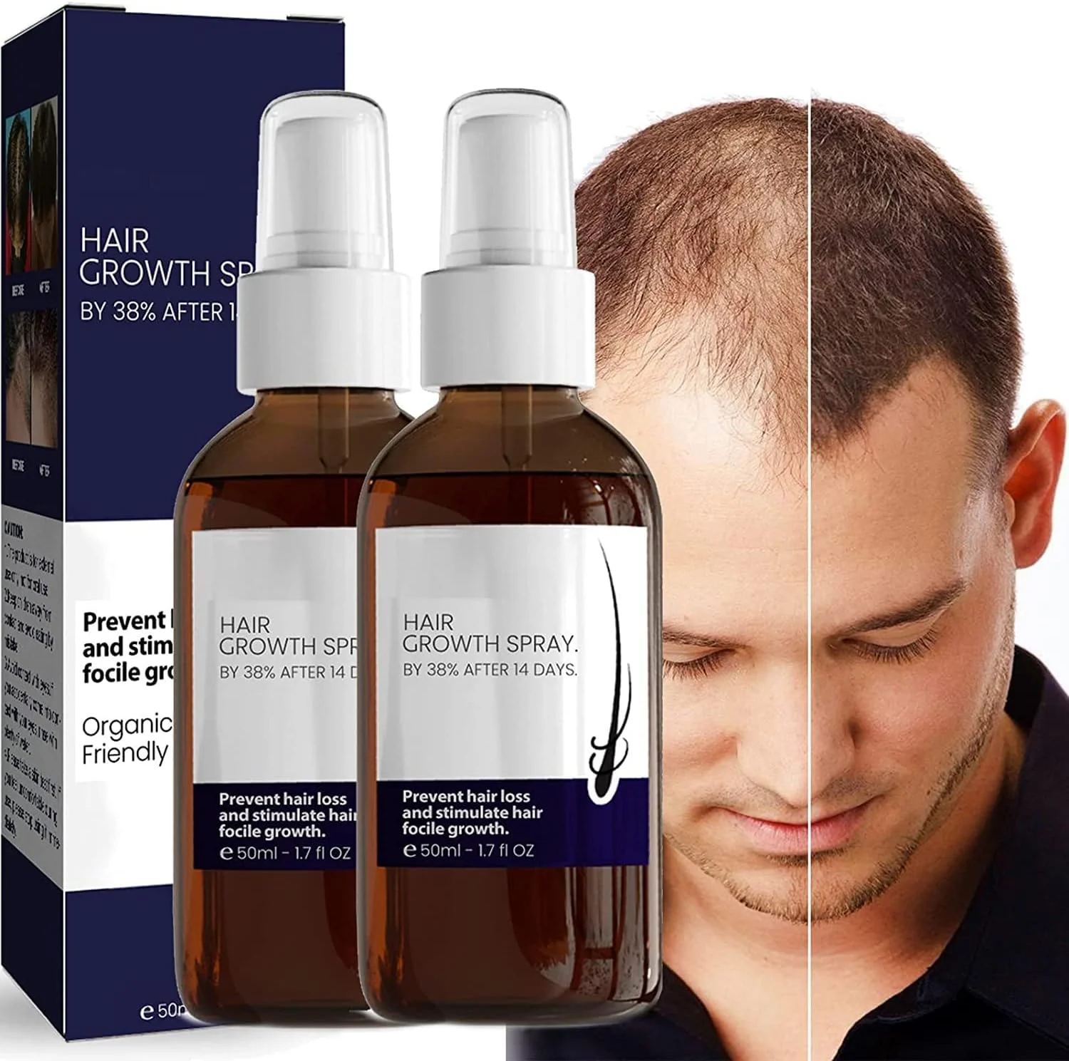 اسپری سرم فرمول رشد مو بلوسومز، اسپری سرم فرمول رشد مو بلوسومز، اسپری رشد مو آشواگاندا 4500، سرم ضد ریزش مو برای موهای خشک، وز و آسیب دیده (2 عدد)