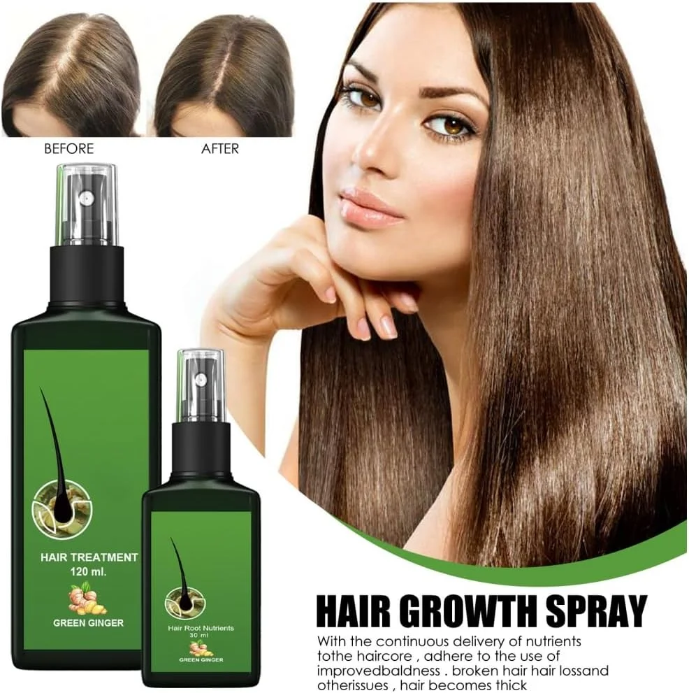 اسپری رشد مو اتومور، سرم مبتنی بر آب با زنجبیل برای جلوگیری از ریزش مو، اسپری سریع رشد مو برای زنان، فرمول مغذی، سرم اسپری سبک و غیر چرب (30 میلی لیتر)