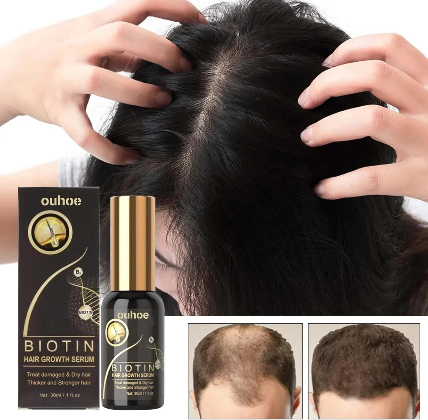 سرم پمپی بیوتین برای رشد مو، سرم ضد ریزش مو، سرم رشد مو، اسپری و تقویت کننده رشد مو، اسانس رشد مجدد مو برای زنان و مردان، سرم رشد مجدد مو، درمان رشد مجدد مو (2 عدد)