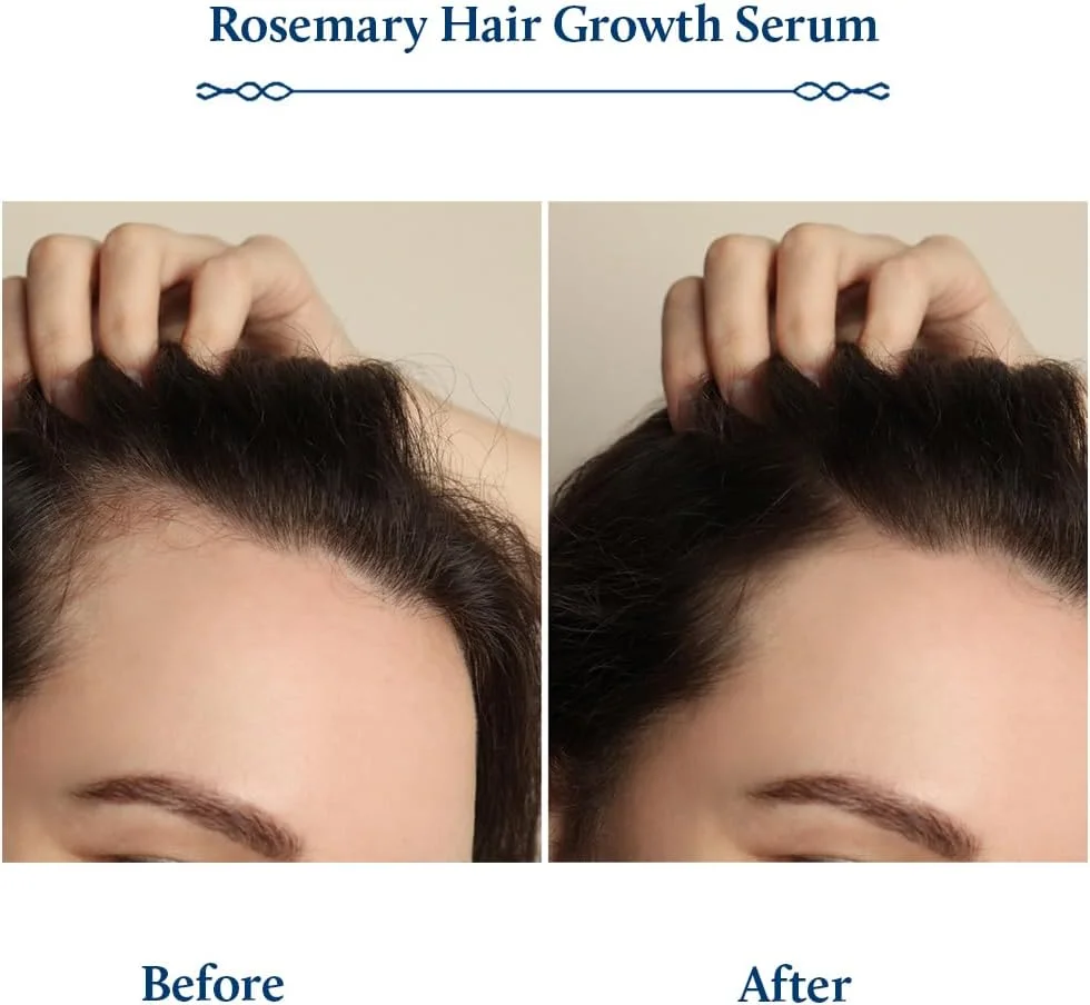 سرم رشد مو رزماری گیاهی پیشرفته بلو نکتار، جایگزین طبیعی برای Redensyl برای رشد مو | سرم موی آیورودا برای زنان و مردان برای مو و پوست سر سالم (8 گیاه، 100 میلی لیتر)
