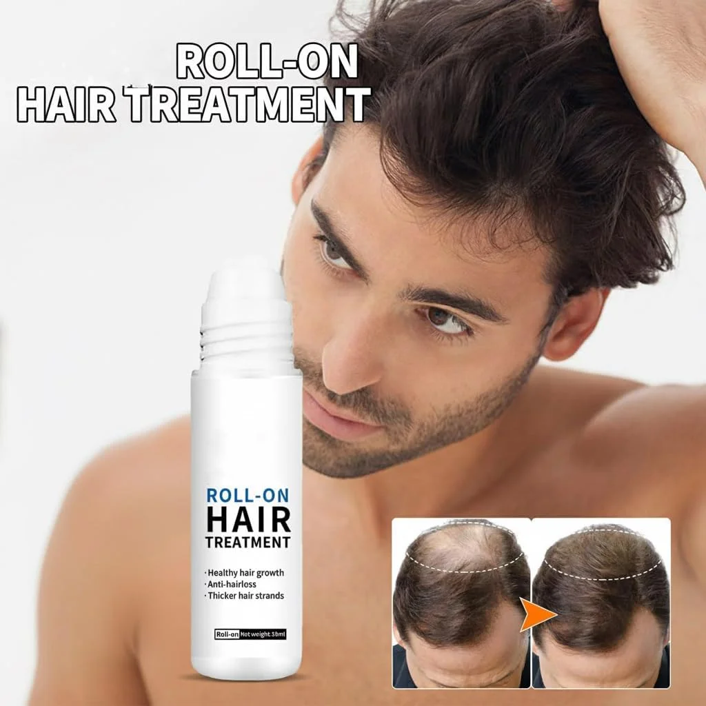 اسپری رشد مجدد مو آزونی، بسته 2 عددی، غلتک رشد مجدد مو، غلتک مو ارگانیک، سرم رشد مو، ضد ریزش مو برای مردان و زنان، ترمیم فولیکول های مو برای لکه های طاسی ریش و نازک شدن مو