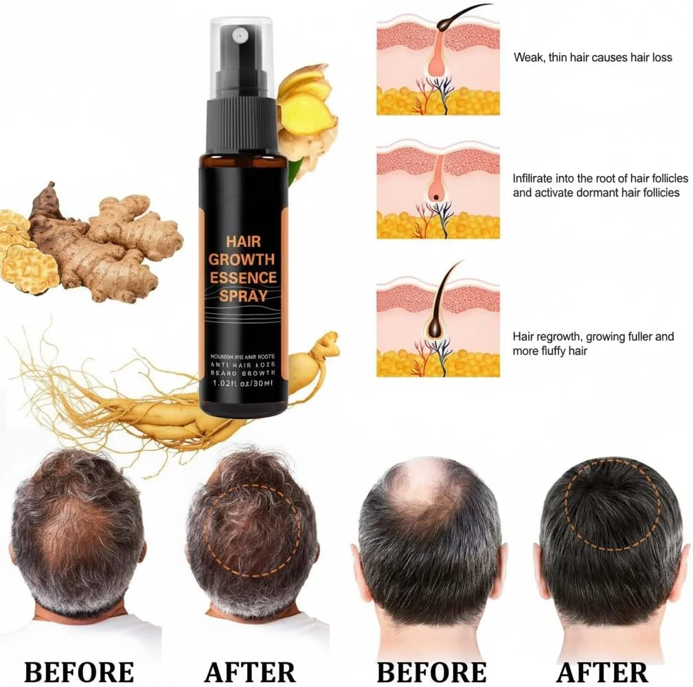 اسپری رشد مجدد مو آزونی، اسپری گیاهی رفع سفیدی مو، صاف کننده و تیره کننده، سرم رشد مو، اسپری افزایش حجم مو، ضد ریزش مو برای زنان و مردان