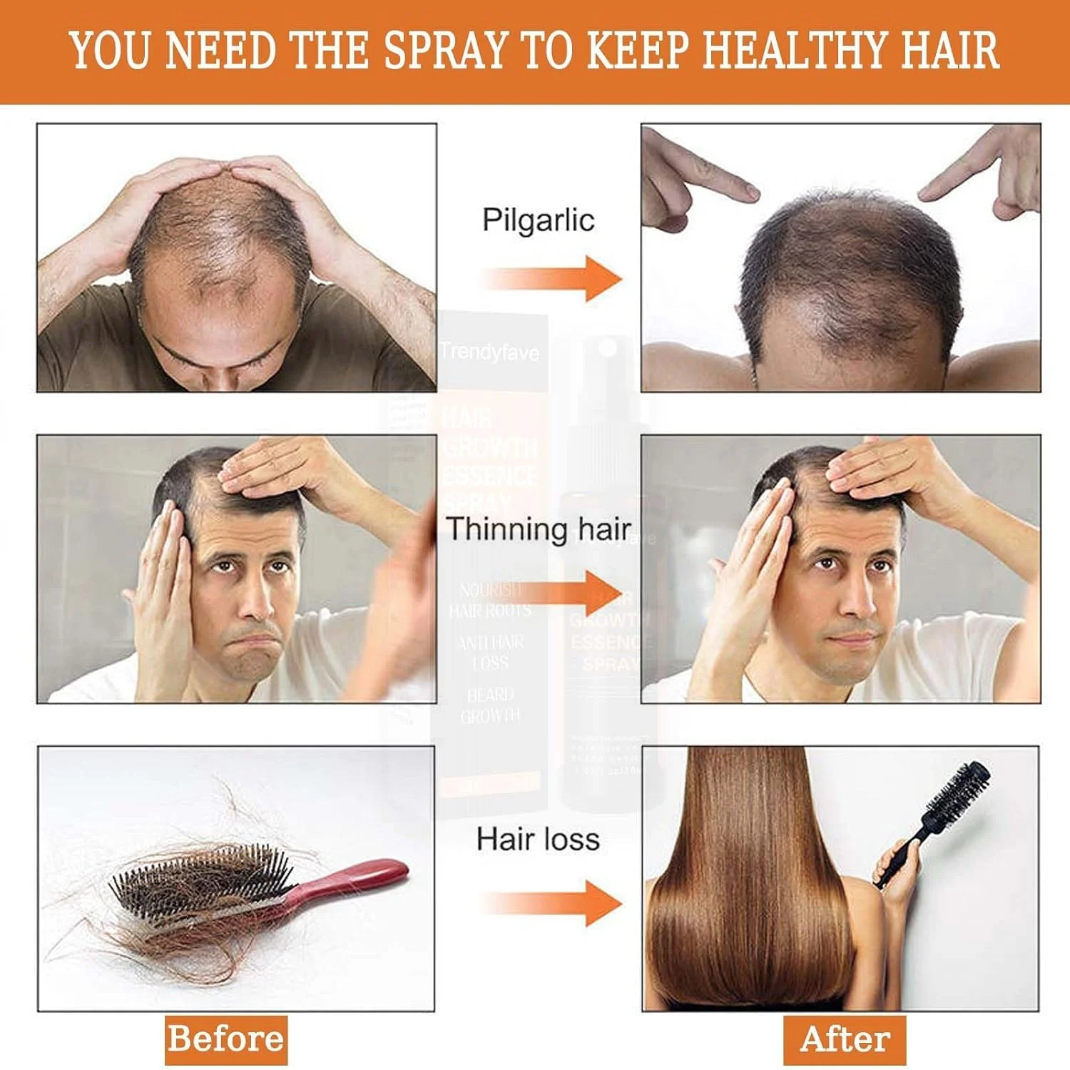 اسپری رشد مجدد مو آزونی، اسپری گیاهی رفع سفیدی مو، صاف کننده و تیره کننده، سرم رشد مو، اسپری افزایش حجم مو، ضد ریزش مو برای زنان و مردان