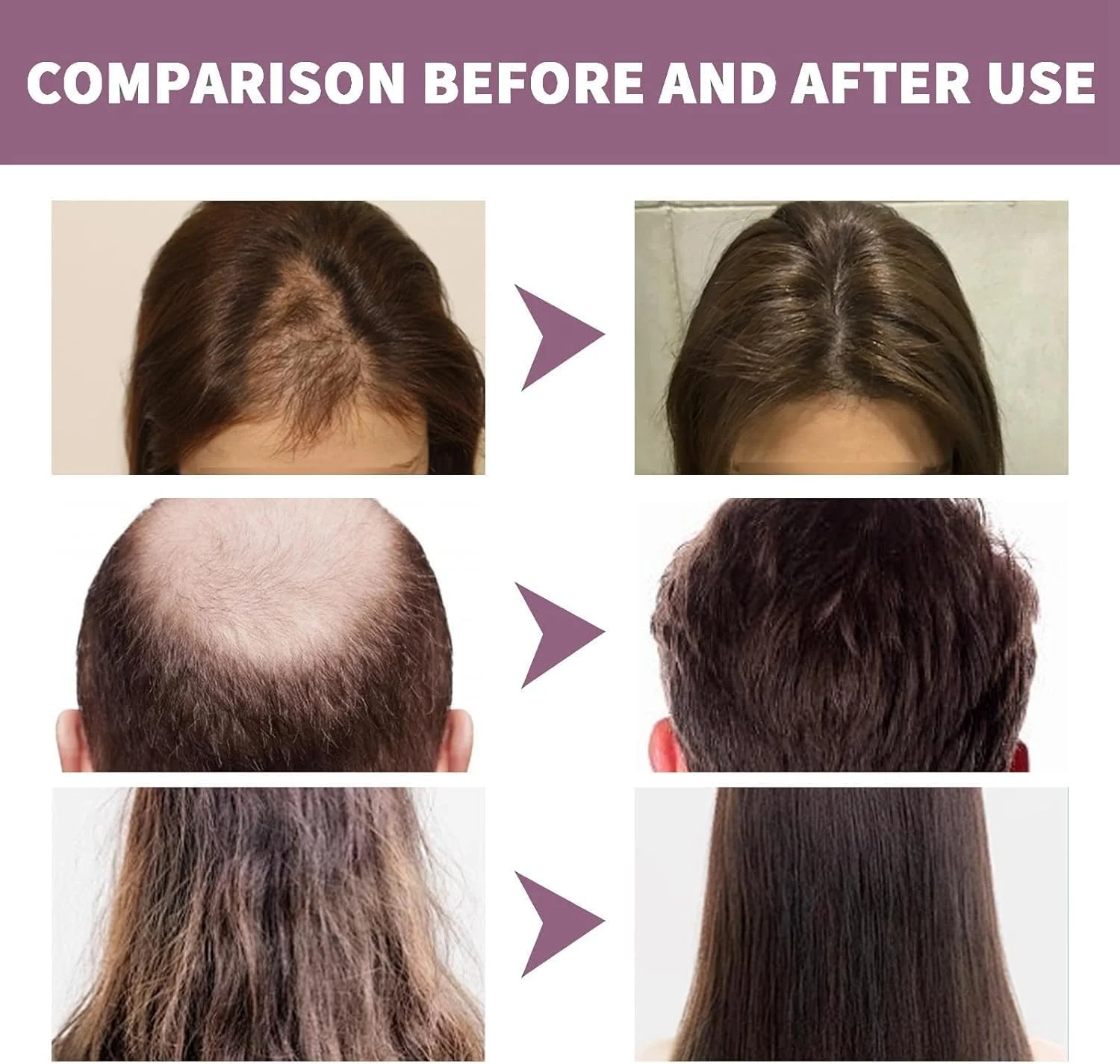 اسپری کمک کننده مو نجیب، اسپری رشد مو، سرم موی طبیعی با کافئین برای موهای ضخیم تر، روغن رشد مو، سرم رشد مو، اسپری ضخیم کننده مو، اسپری ضد ریزش مو، اسپری رشد مجدد مو