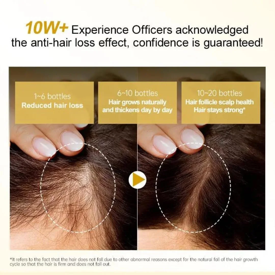 سرم ضد ریزش و رشد مو نیکیتا ویوی 50 میلی لیتر | مراقبت 3 در 1 ضد ریزش مو، رشد مو و حالت دهنده پوست سر | سرم افزایش تراکم مو با بیوتین | سرم اسانس درمان رشد مجدد مو