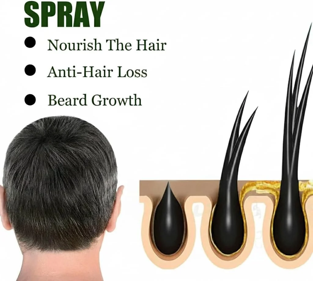 اسپری رشد مو NALACAL، سرم رشد مو برای رشد مجدد مو، اسپری ضخیم کننده مو و مراقبت از موی سر، ترمیم مو، درمان ضد ریزش مو برای زنان و مردان (100 میلی لیتر) اسپری رشد مو NALACAL، سرم رشد مو برای رشد مجدد مو، اسپری ضخیم کننده مو و مراقبت از موی سر، ترمیم مو، درمان ضد ریزش مو برای زنان و مردان (100 میلی لیتر)