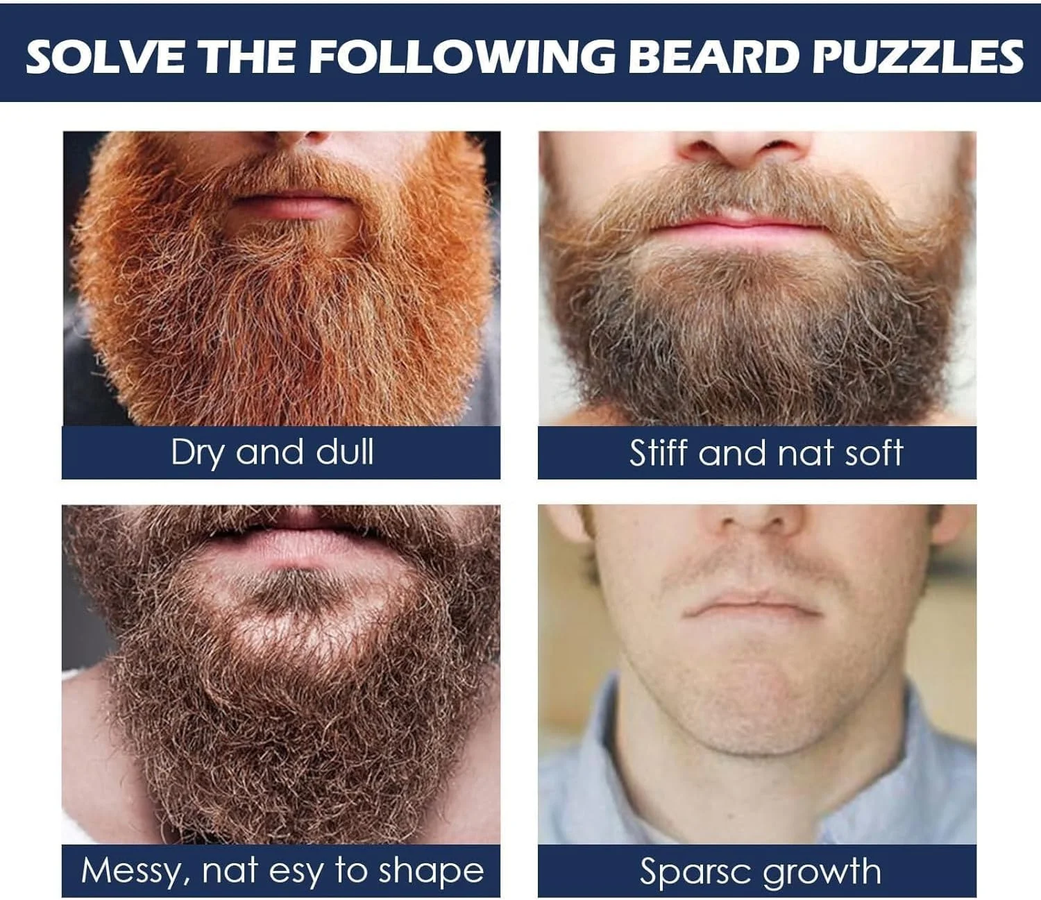 اسپری تقویت کننده رشد مو و ریش بیوتین NALACAL، بسته 2 عددی - سرم رشد مجدد مو برای مردان و زنان - افزایش ضخامت و پرپشتی مو و ریش، ایده آل برای درمان ریزش و کم پشتی مو