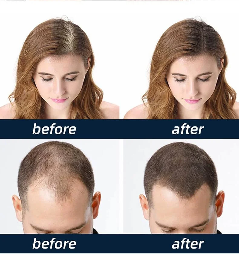 اسپری بیوتین HairRevive نالاکال، سرم اسانس رشد مو برای موهای ضخیم تر، بلندتر و قوی تر، درمان پوست سر با بیوتین، 2 عدد اسپری بیوتین HairRevive نالاکال، سرم اسانس رشد مو برای موهای ضخیم تر، بلندتر و قوی تر، درمان پوست سر با بیوتین، 2 عدد