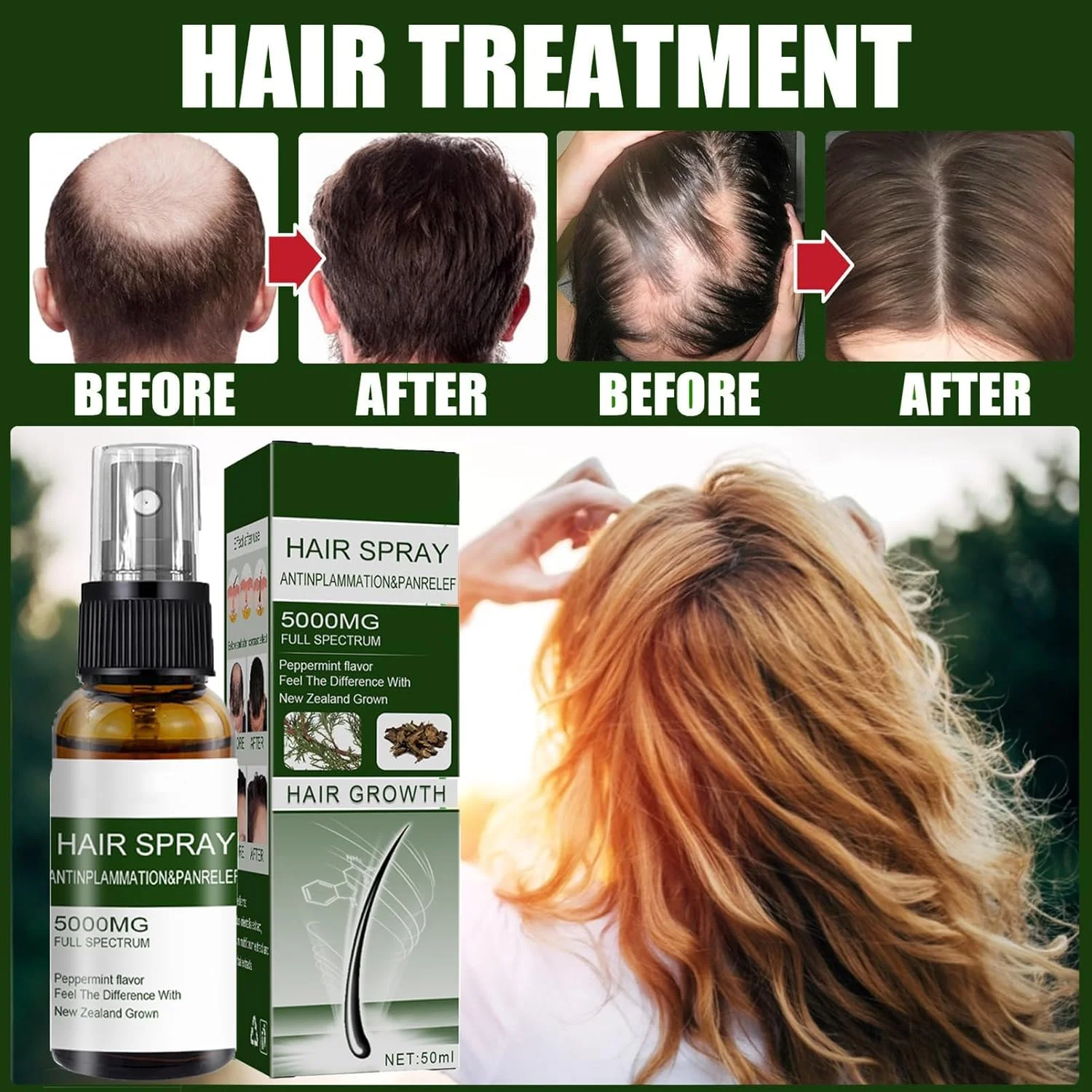 اسپری رشد مو NALACAL، سرم رشد مو برای رشد مجدد مو، اسپری ضخیم کننده مو و مراقبت از موی سر، ترمیم مو، درمان ضد ریزش مو برای زنان و مردان (100 میلی لیتر) اسپری رشد مو NALACAL، سرم رشد مو برای رشد مجدد مو، اسپری ضخیم کننده مو و مراقبت از موی سر، ترمیم مو، درمان ضد ریزش مو برای زنان و مردان (100 میلی لیتر)