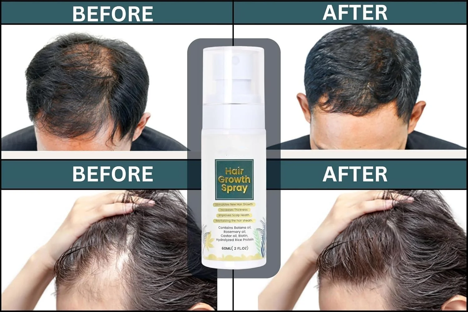 اسپری رشد مو نالاکال (60 میلی لیتر): فرمول طبیعی با روغن باتانا، کرچک، رزماری، آب برنج و بیوتین - درمان مراقبت از پوست سر برای موهای نازک، رشد مجدد و ضخیم شدن مو برای زنان و مردان اسپری رشد مو نالاکال (60 میلی لیتر): فرمول طبیعی با روغن باتانا، کرچک، رزماری، آب برنج و بیوتین - درمان مراقبت از پوست سر برای موهای نازک، رشد مجدد و ضخیم شدن مو برای زنان و مردان