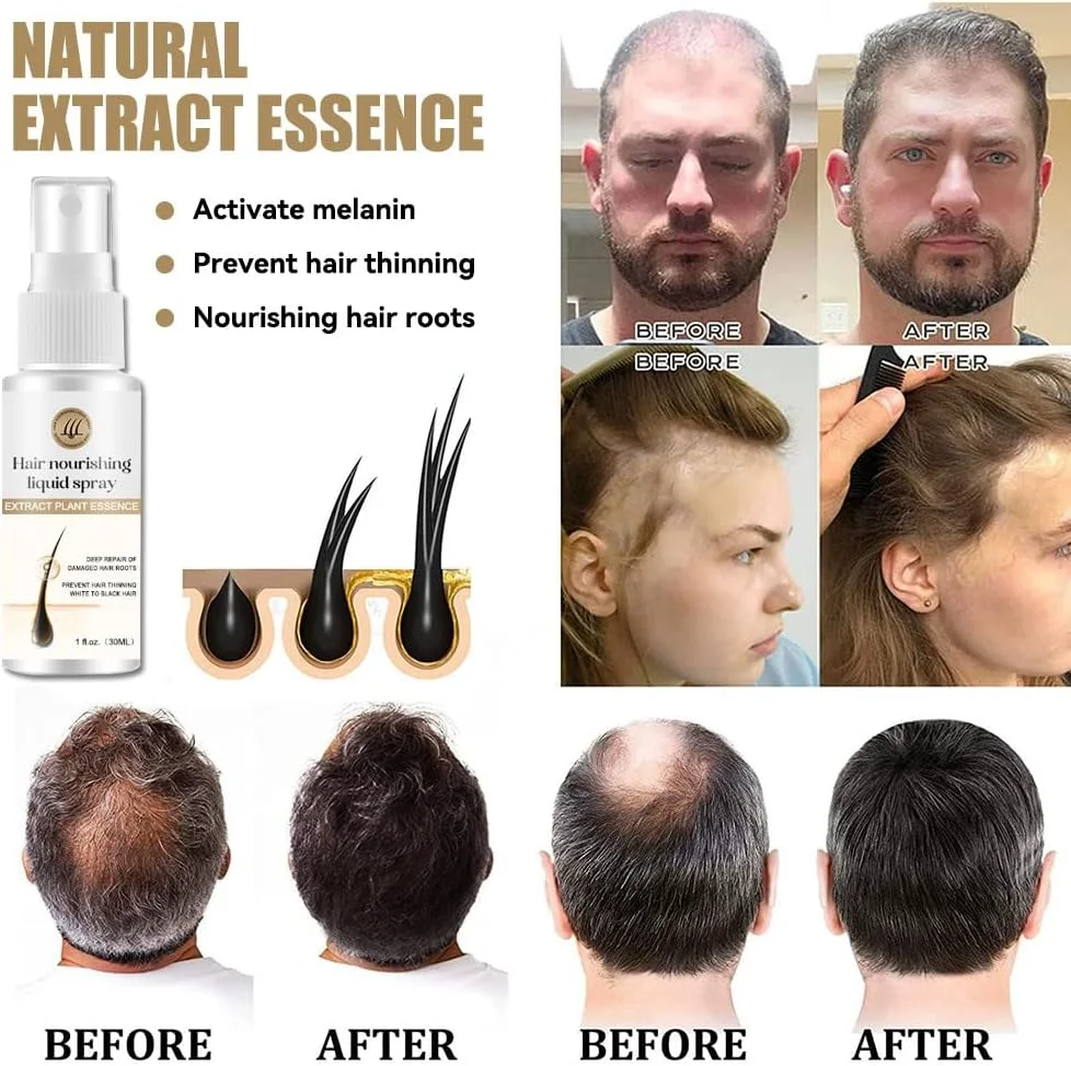 اسپری بیوتین HairRevive نالاکال، سرم اسانس رشد مو برای موهای ضخیم تر، بلندتر و قوی تر، درمان پوست سر با بیوتین، 2 عدد اسپری بیوتین HairRevive نالاکال، سرم اسانس رشد مو برای موهای ضخیم تر، بلندتر و قوی تر، درمان پوست سر با بیوتین، 2 عدد