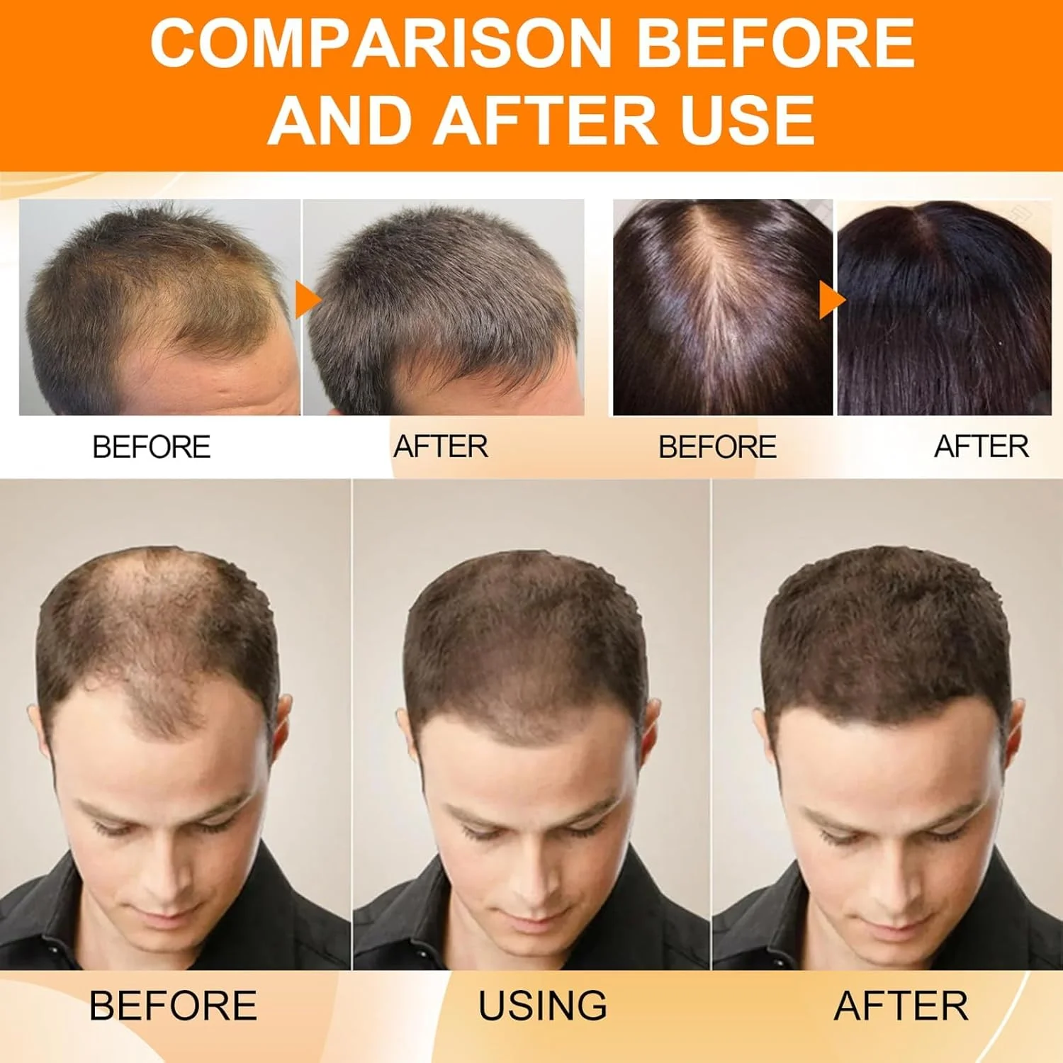 روغن رزماری آزونی برای رشد مو، روغن رشد مو 60 میلی لیتری، روغن ضروری طبیعی برای تراکم مو، آبرسانی، ترمیم موهای خشک و آسیب دیده، بدون تحریک پوست سر، درمان تقویت کننده مو برای زنان روغن رزماری آزونی برای رشد مو، روغن رشد مو 60 میلی لیتری، روغن ضروری طبیعی برای تراکم مو، آبرسانی، ترمیم موهای خشک و آسیب دیده، بدون تحریک پوست سر، درمان تقویت کننده مو برای زنان