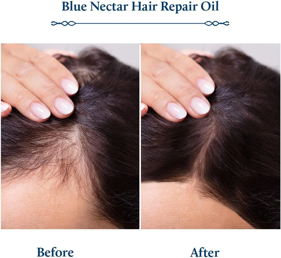 روغن رزماری Blue Nectar برای رشد مو به همراه روغن برینگراج | جایگزین طبیعی برای Redensyl | روغن موی غیر چسبنده آیورودا با روغن آملا (9 گیاه، 200 میلی لیتر) روغن رزماری Blue Nectar برای رشد مو به همراه روغن برینگراج | جایگزین طبیعی برای Redensyl | روغن موی غیر چسبنده آیورودا با روغن آملا (9 گیاه، 200 میلی لیتر)